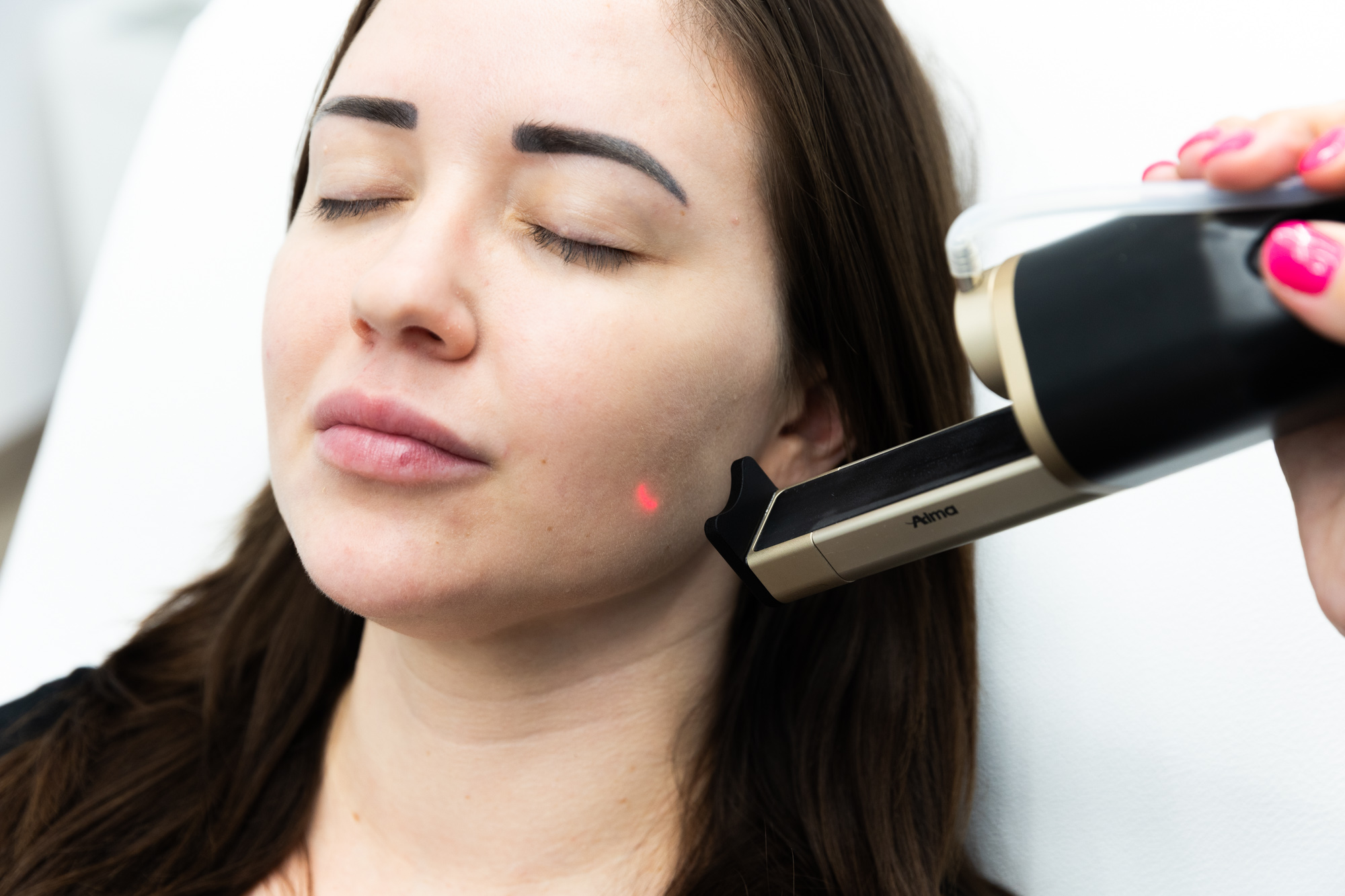 Woman enjoying the benefits of Laser Skin Resurfacing